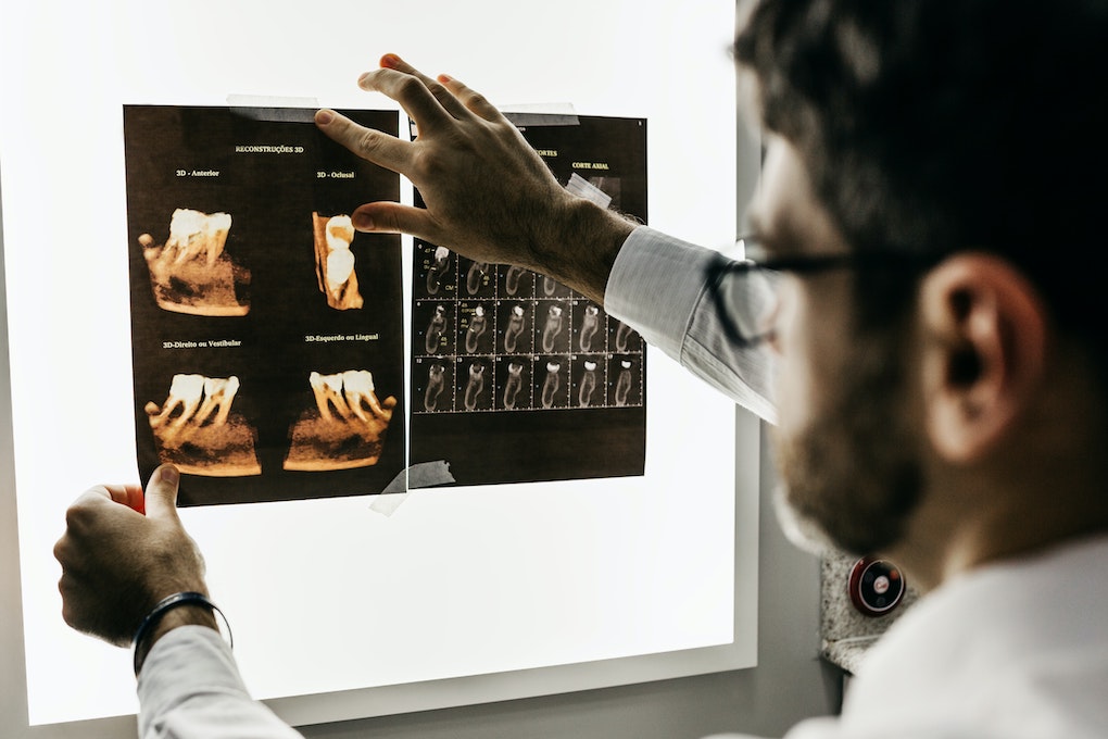 dentist reviewing X-rays