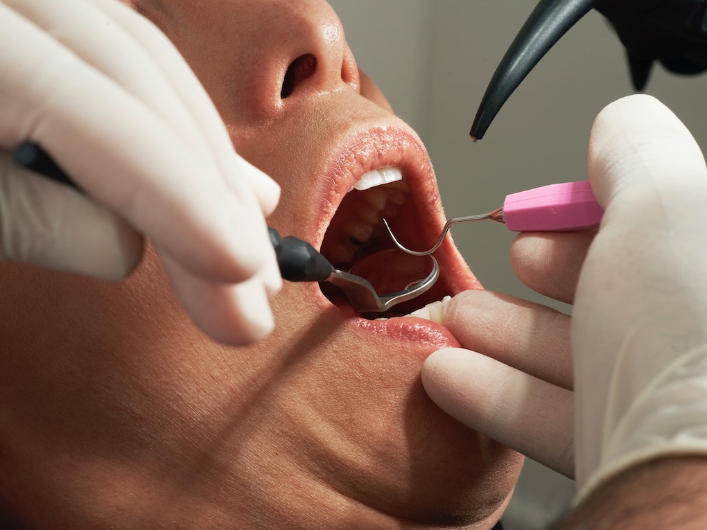 person getting dental work