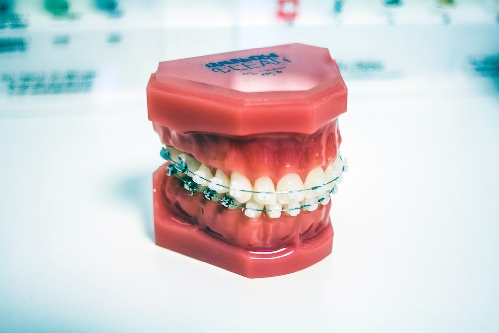 dental mold with braces