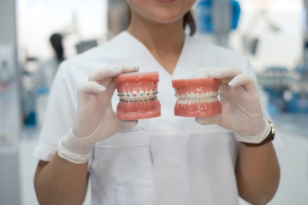 dentist holding two molds